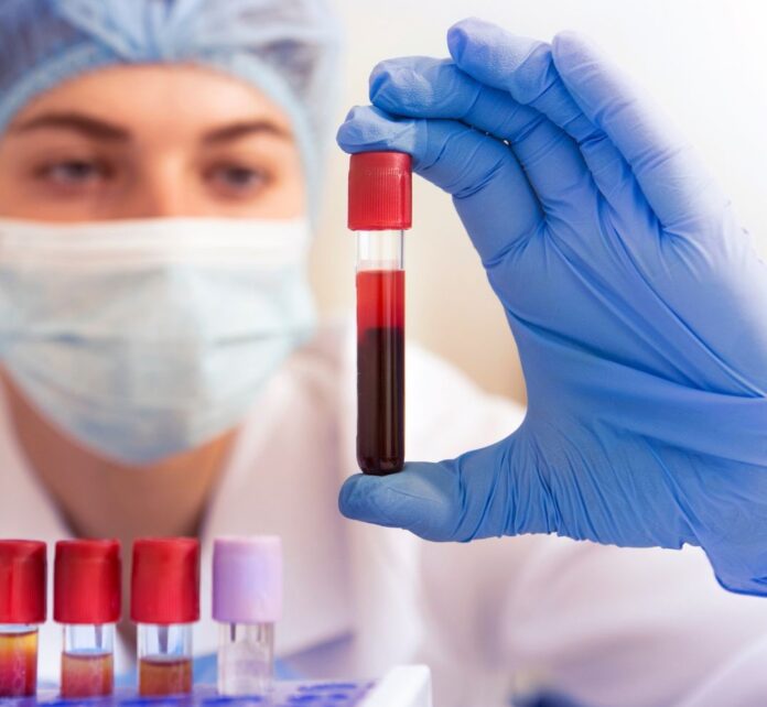 Linha
Hemossedimentação